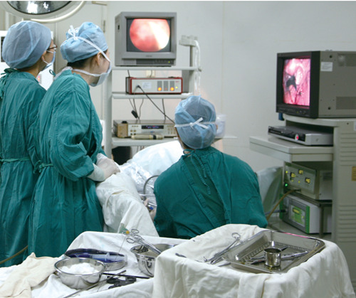 宫腔镜手术